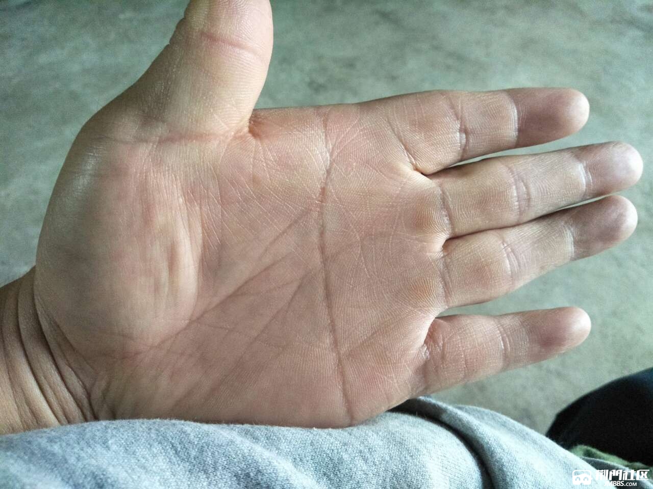 人家都说我这手打人疼这种手打人疼吗懂得帮忙看一下呢